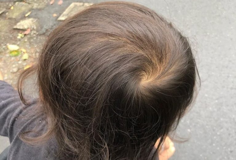 hair whorl superstition velacurls